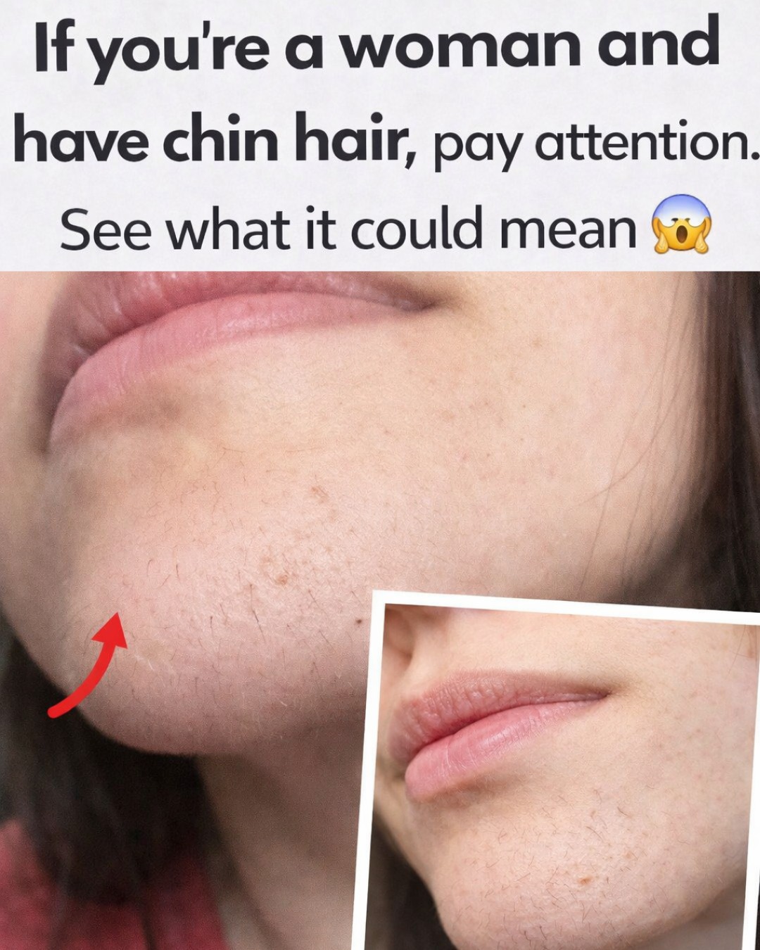 Chin Hair in Women: What Causes It and When to Pay Attention to Your Hormones
