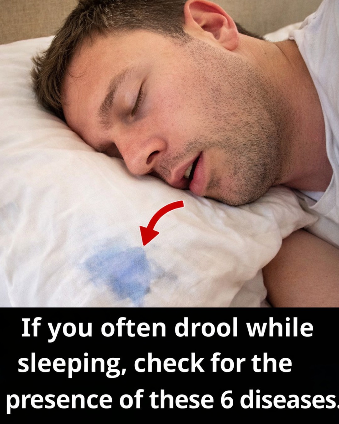 Waking Up With a Wet Pillow Every Morning? 8 Common Triggers for Nighttime Drooling You Need to Know