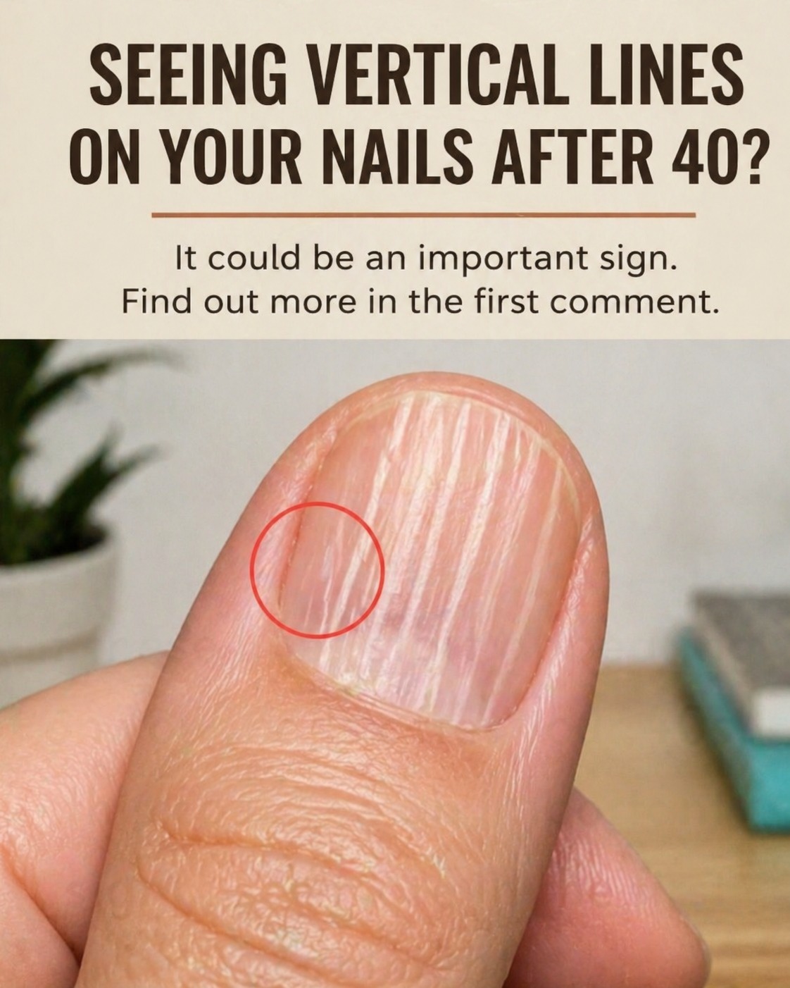 Why Do Vertical Ridges Appear on Fingernails After You Turn 40? Here’s the Truth