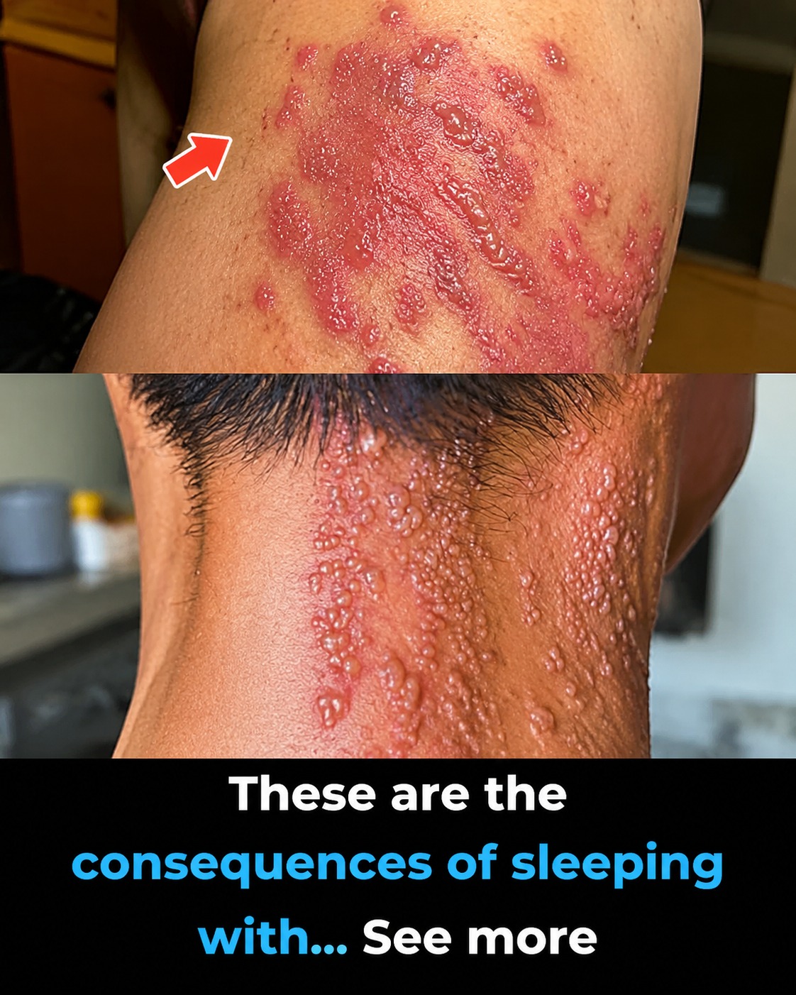 These Are the Hidden Consequences of Sleeping With the Wrong Person: The HPV Reality