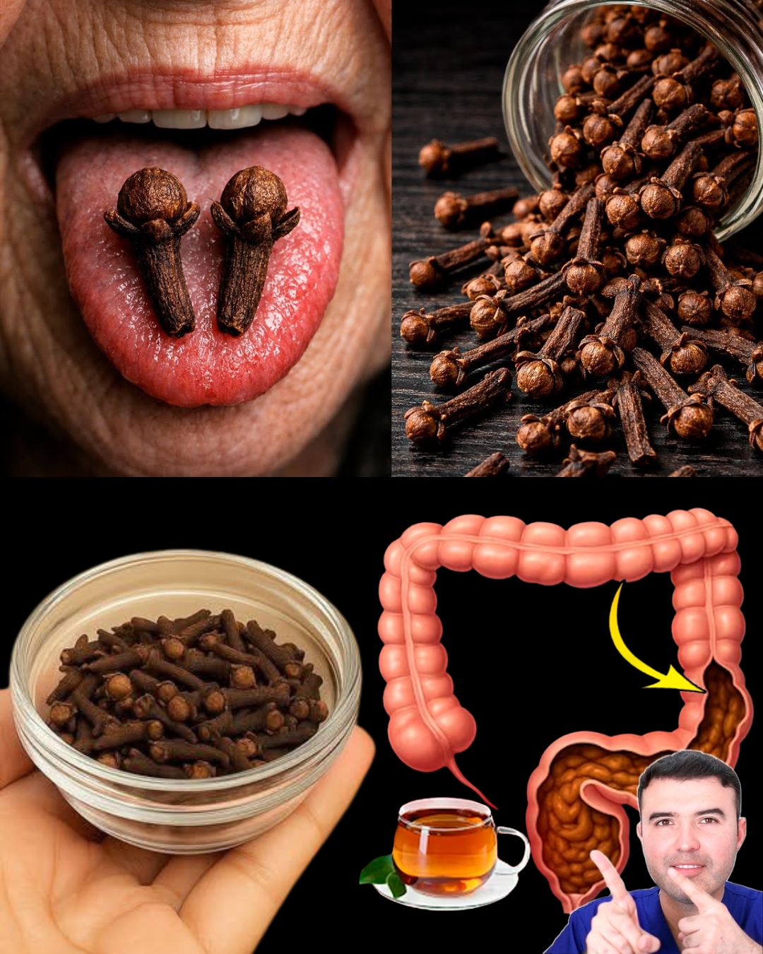 Why Surgeons Use Cloves: The Eugenol Secret