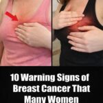 What Are the 10 Important Breast Changes That Many Women Overlook and Should Discuss With Their Doctor?